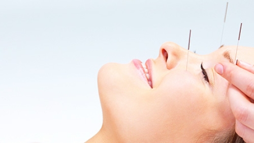 AKUPUNKTUR TEDAVİ MERKEZİ